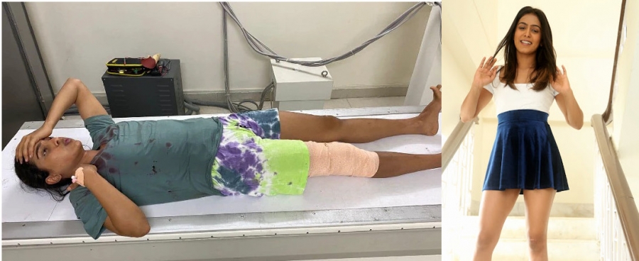 Actress samyuktha hegde was injured in an accident during the shooting of the movie!